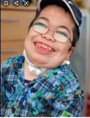 هیولای بیماری ام پی اس در افغانستان قسمت دوم